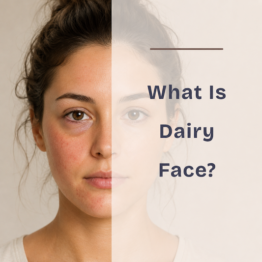 Dairy Face: What It Is, Symptoms & Before/After Photos