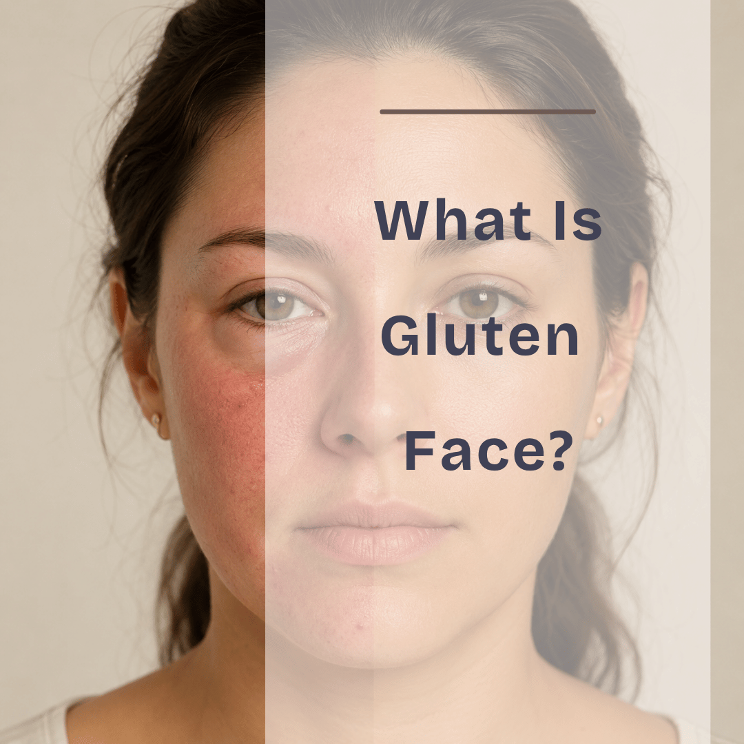 Gluten Face: Symptoms, Before & After Photos, and How to Reverse It